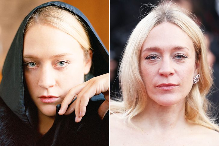 How Plastic Surgery Dramatically Changed These Celebrities Page Of I Am Famous