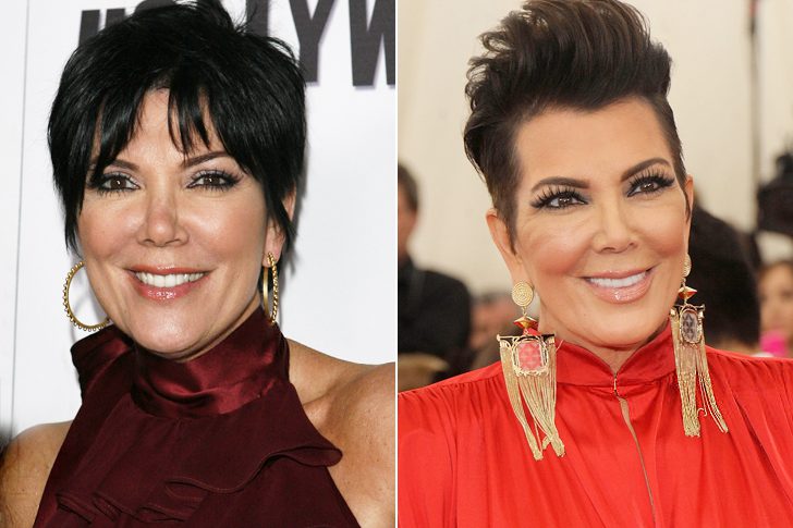 How Plastic Surgery Dramatically Changed These Celebrities Page 45 Of   Kris Jenner 