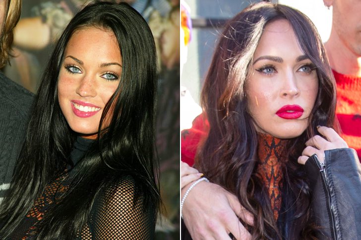 How Plastic Surgery Dramatically Changed These Celebrities Page Of I Am Famous